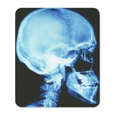 CafePress Skull X Ray Non-slip Rubber Mousepad, Gaming Mouse Pad (1158223942) picture
