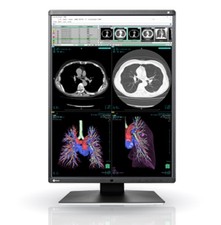 EIZO RadiForce RX360 Monitor picture