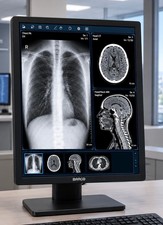 Barco Nio Color MDNC-2521 2MP Diagnostic Radiology Display Monitor 21 inch picture